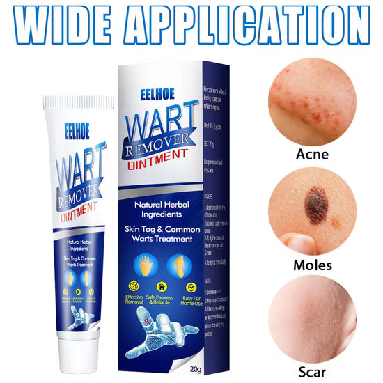Pimple & wart remover ointment