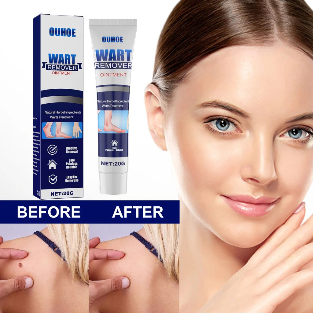 Pimple & wart remover ointment